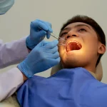 Tooth Extraction